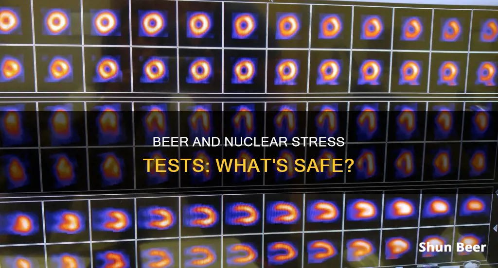 can you drink beer before a nuclear stress test