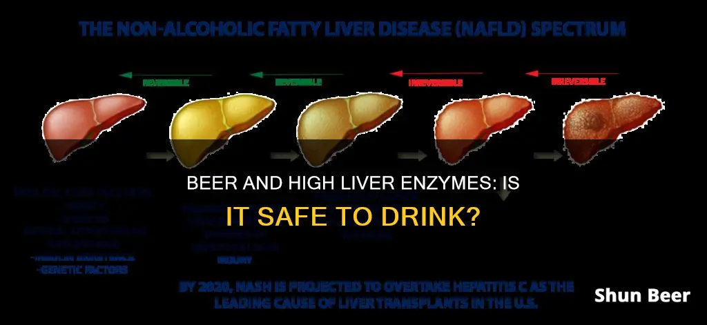 can you drink beer if you have high liver enzymes