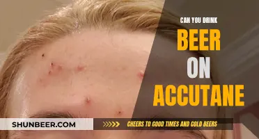 Accutane and Alcohol: Is Beer Safe?