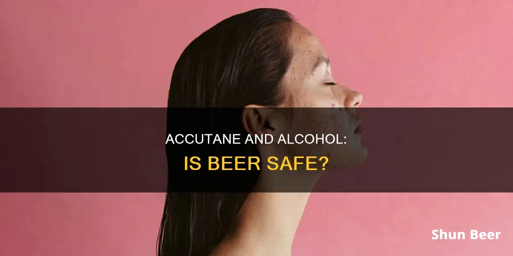 can you drink beer on accutane