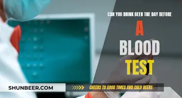 Beer and Blood Tests: What You Need to Know