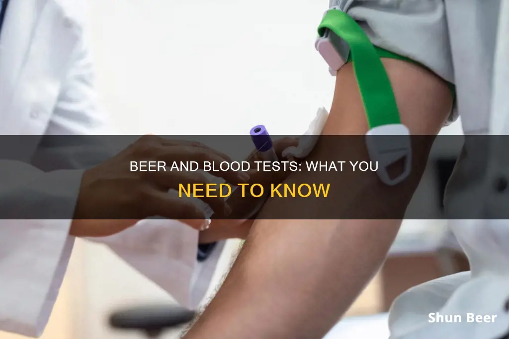 can you drink beer the day before a blood test