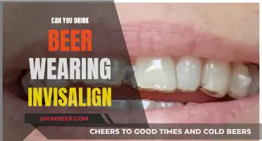 Beer and Invisalign: What You Should Know