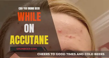 Accutane and Alcohol: Is It Safe to Drink Beer?