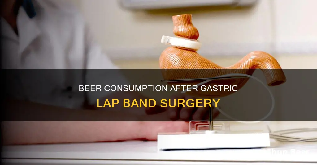 can you drink beer with gastric lap band surgery