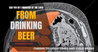 Beer Drinking and Liver Cirrhosis: What's the Link?