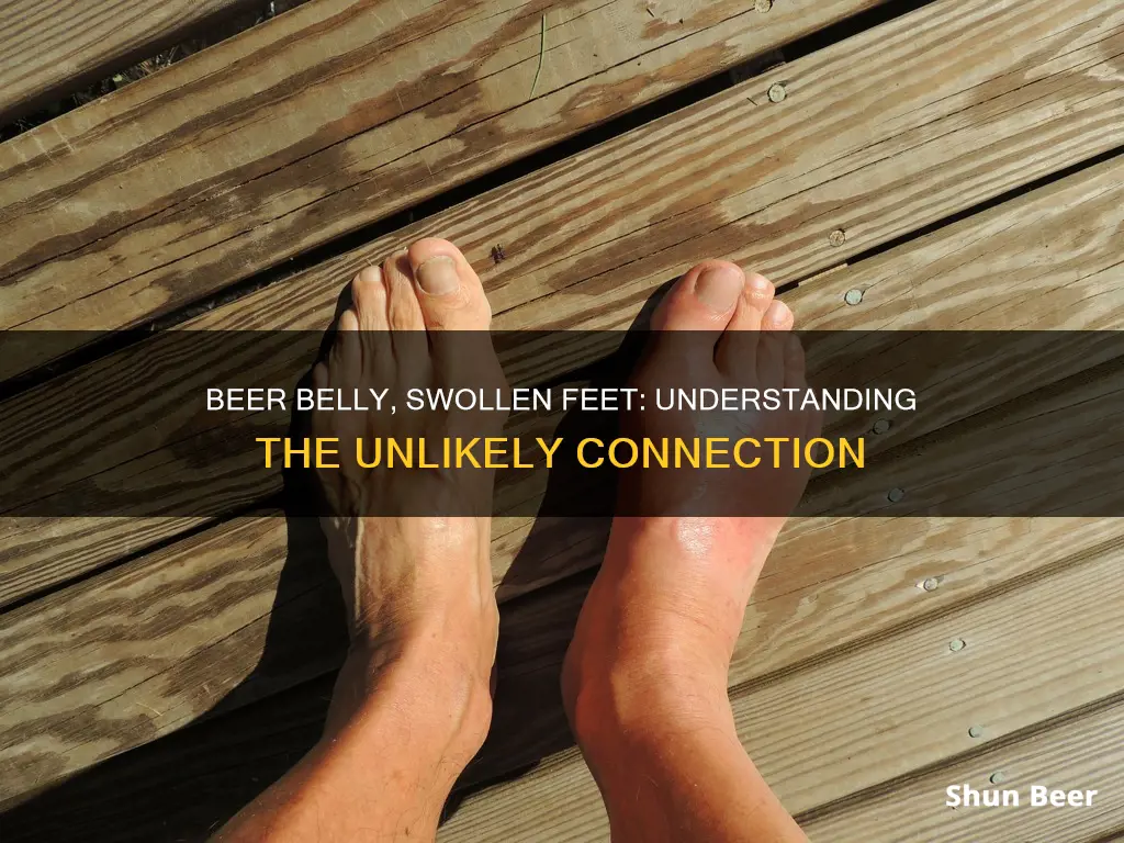 can your feet swell up from drinking beer