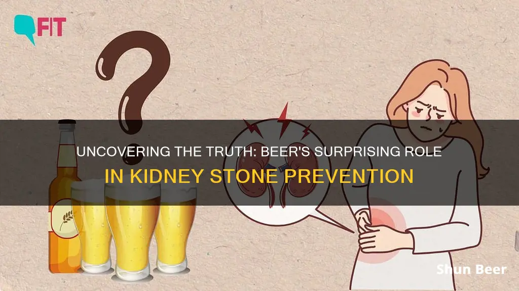 does a beer a day keep kidney stones away