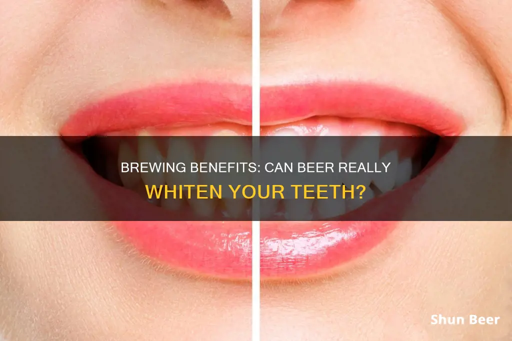 does beer clean teeth