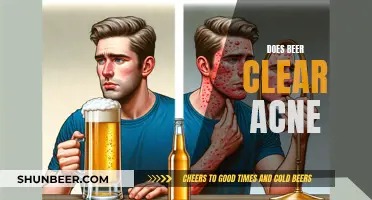 Brewing Benefits: Can Beer Clear Your Skin?