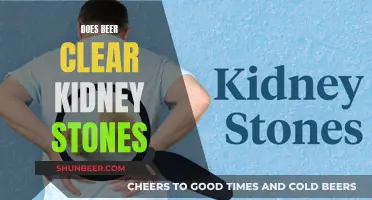 Beer's Role in Kidney Stone Prevention: Fact or Fiction?