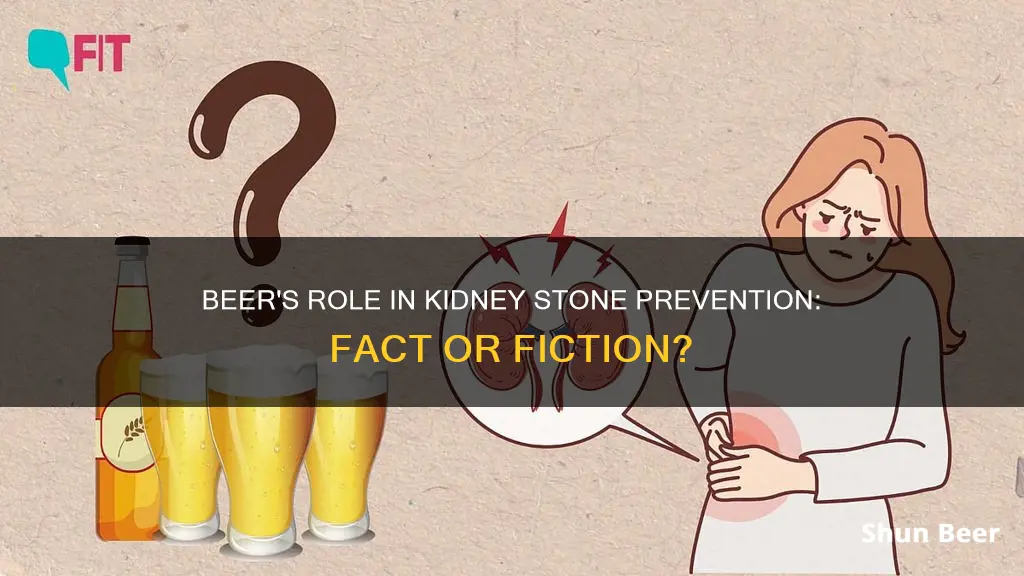 does beer clear kidney stones