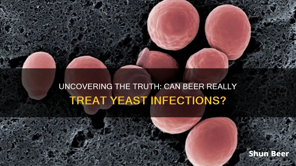 does beer cure yeast infection