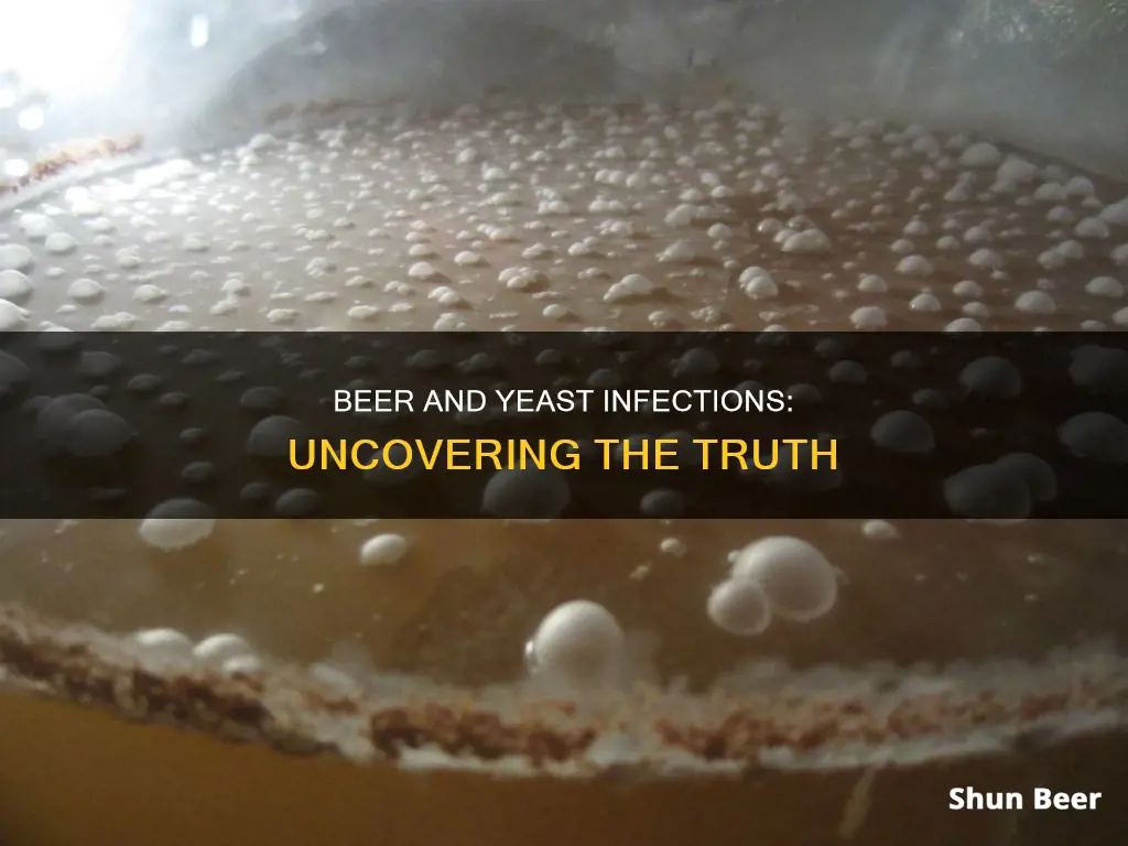 does beer give you a yeast infection