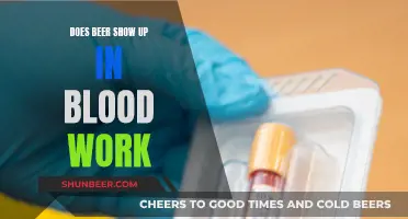 Beer and Blood Work: What's the Connection?