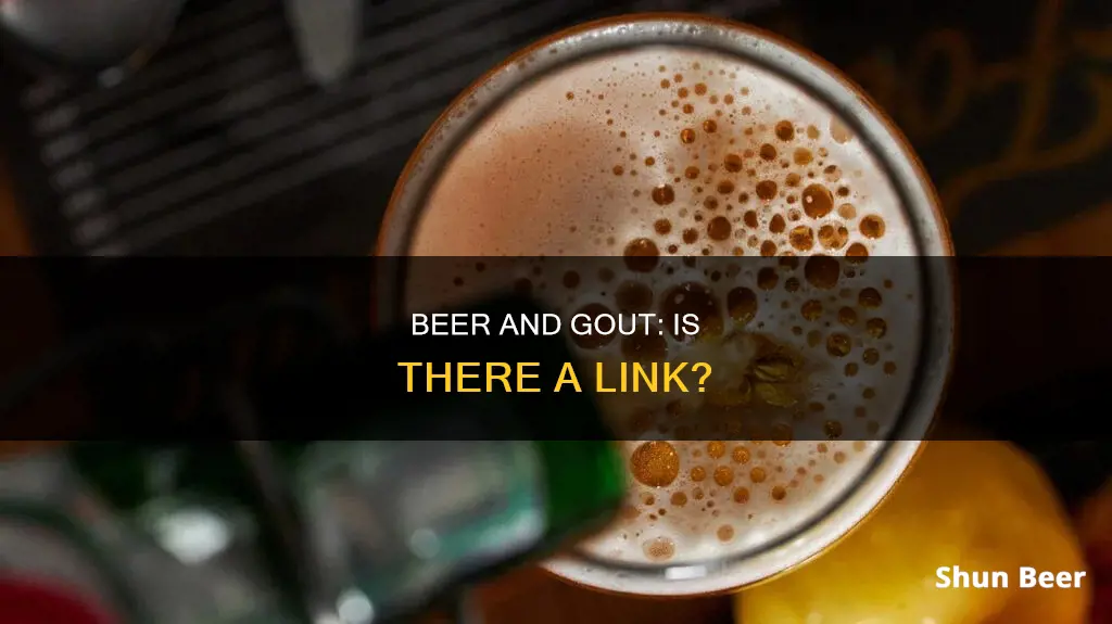 does drinking beer cause gout