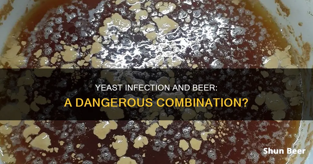 does drinking beer make a yeast infection worse