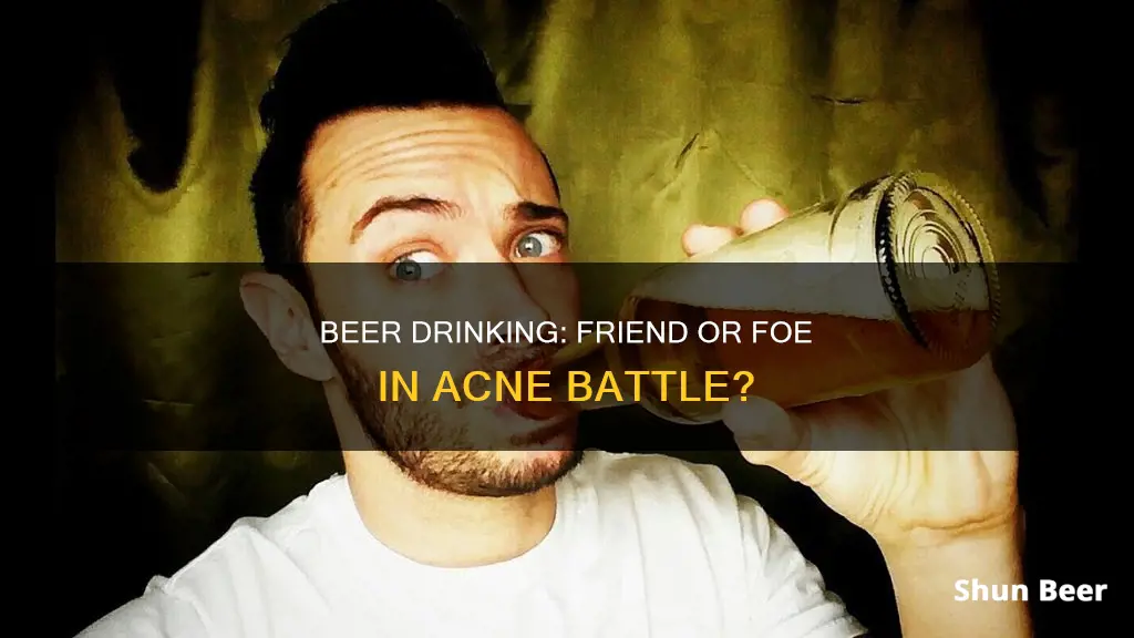 does drinking beer reduce acne