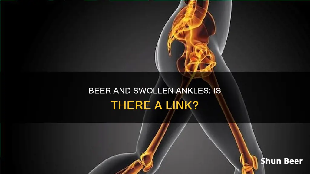 does drinking too much beer cause swelling in the ankles