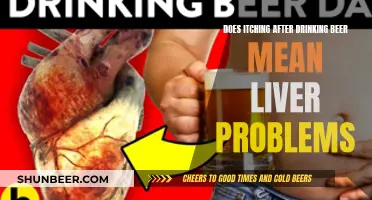 Beer Itching: A Sign of Liver Problems?