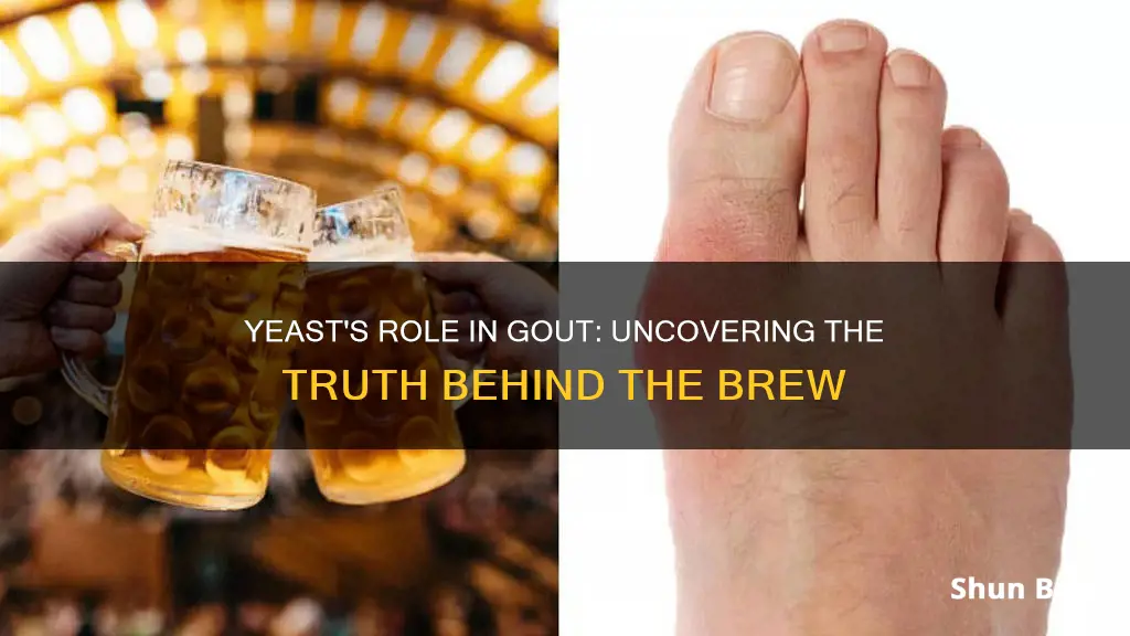 does the yeast in beer trigger gout