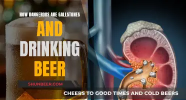 Gallstones and Beer: A Dangerous Mix?