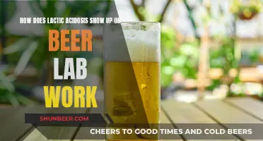 Lactic Acidosis in Beer: Lab Work Indicators