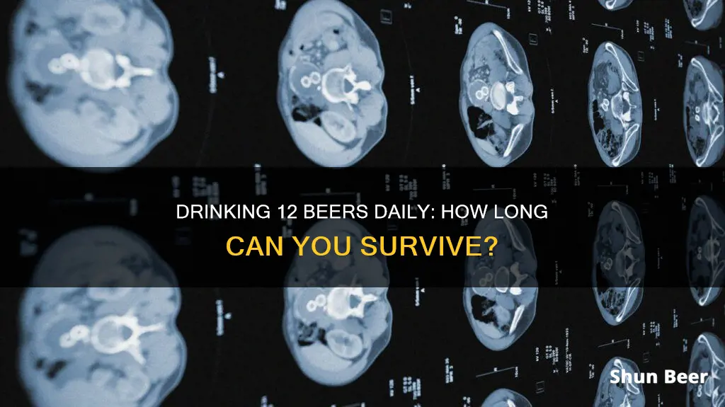 how long can you live drinking 12 beers a day