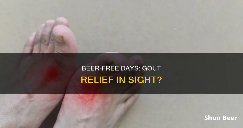 how many days without beer until gout goes away