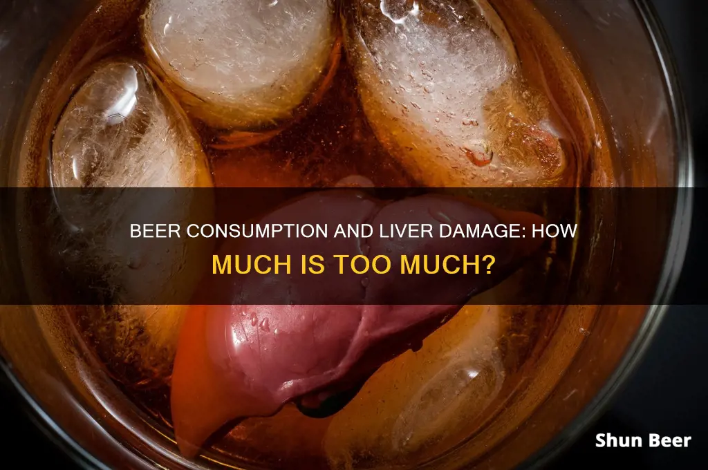 how much beer can you drink before liver damage