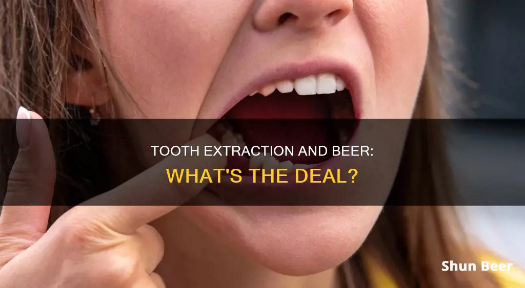 is it okay to drink beer after tooth extraction