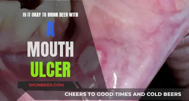 Beer and Mouth Ulcers: Is It Safe to Drink?