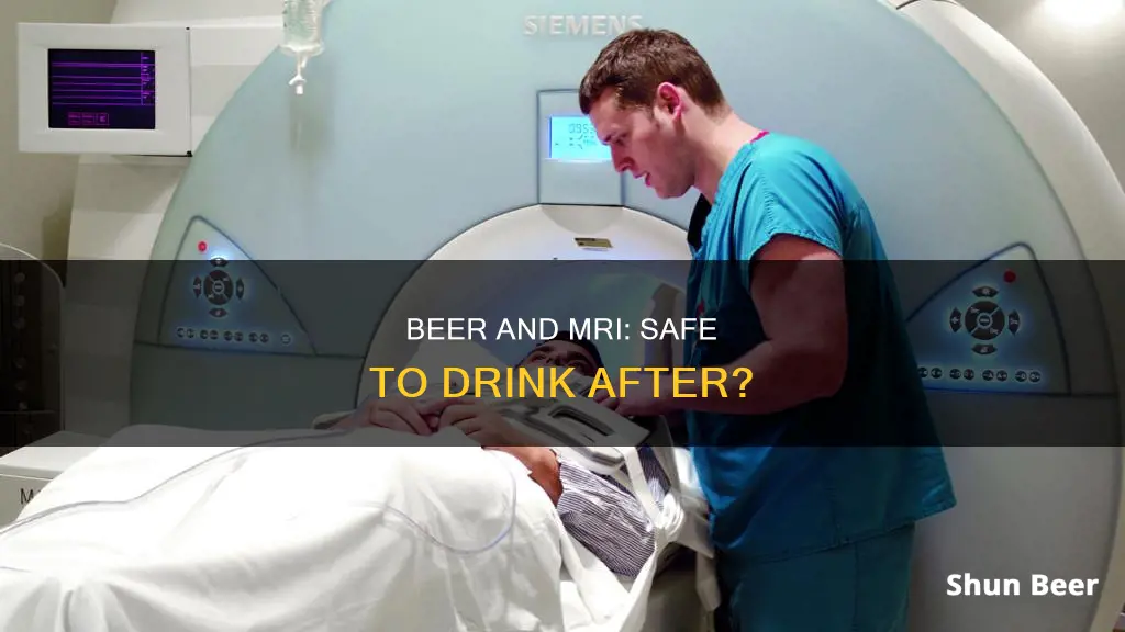 is it safe to drink beer after an mri