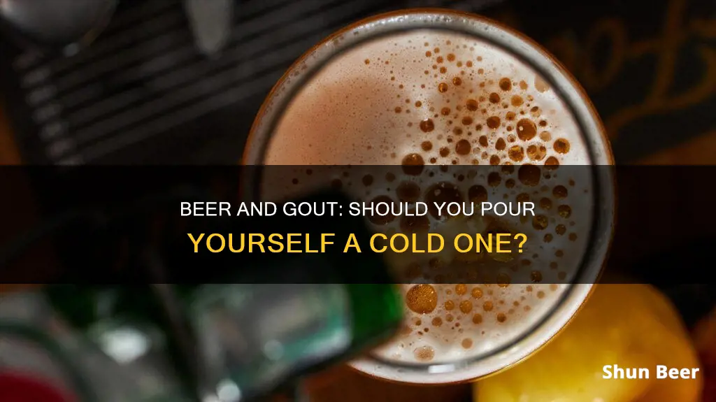 should you drink beer if you have gout