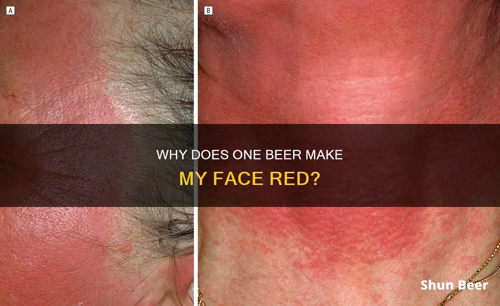 what cauces red face when drinking one beer