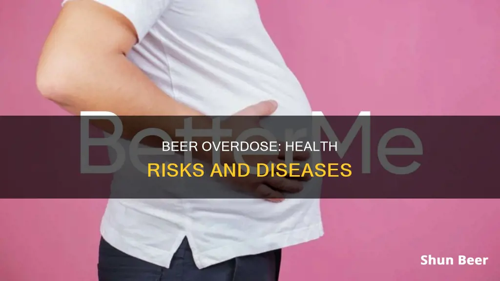 what diseases can you get from drinking too much beer