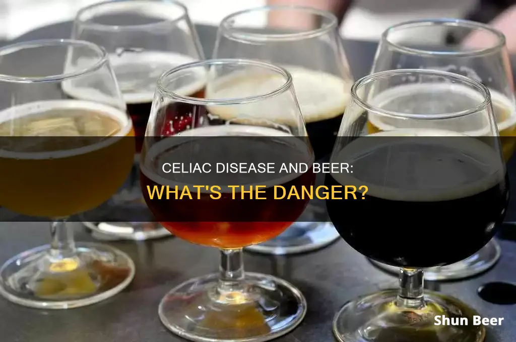 what happens if you drink beer with celiac disease