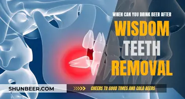 Wisdom Teeth Removal: Beer Drinking Timeline